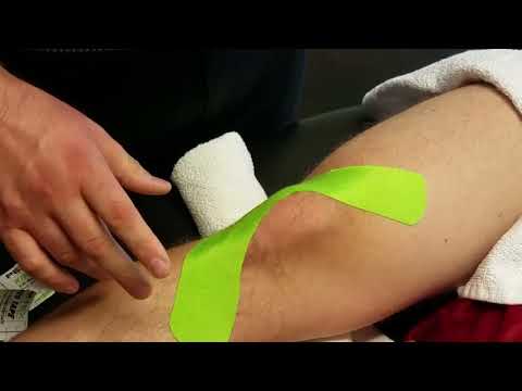 Kinesio taping for IT band syndrome 