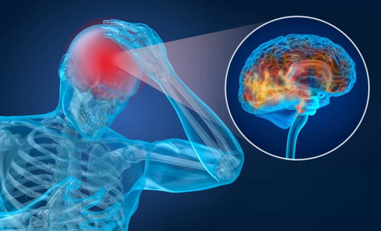 What is a Concussion and What to do if you have one